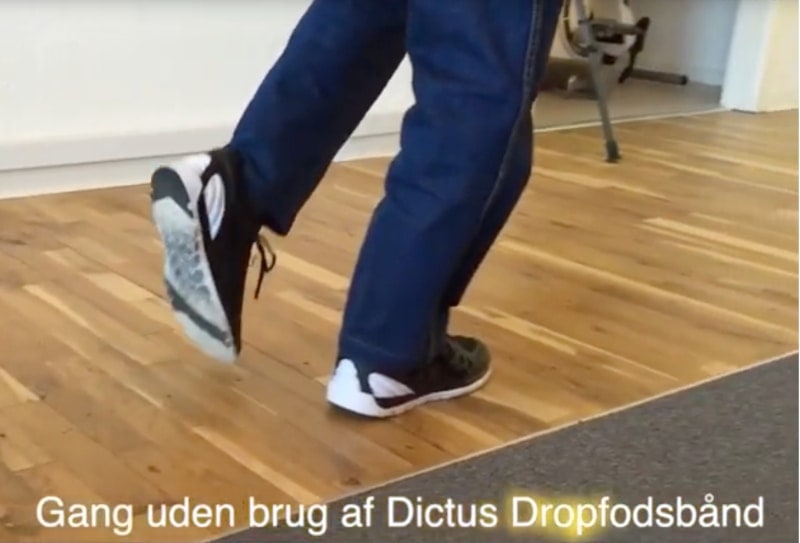 Dropfodsskinne - Dropfodsbånd